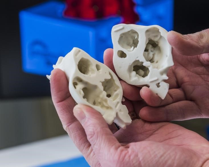 用3D打印，給你做個超級英雄的假肢